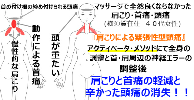 肩こり頭痛 肩こり頭痛
