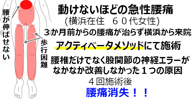 腰痛 腰痛